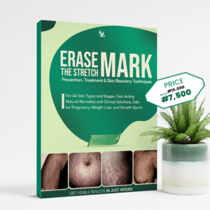 STRETCH-MARK-EBOOK